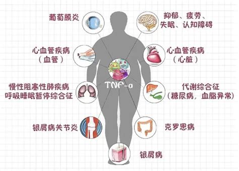 多病|中国老年人慢性病多病共存模式的研究